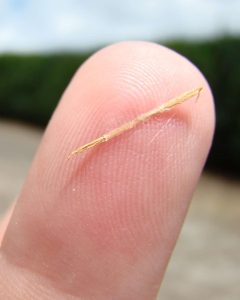 Finger Splinter